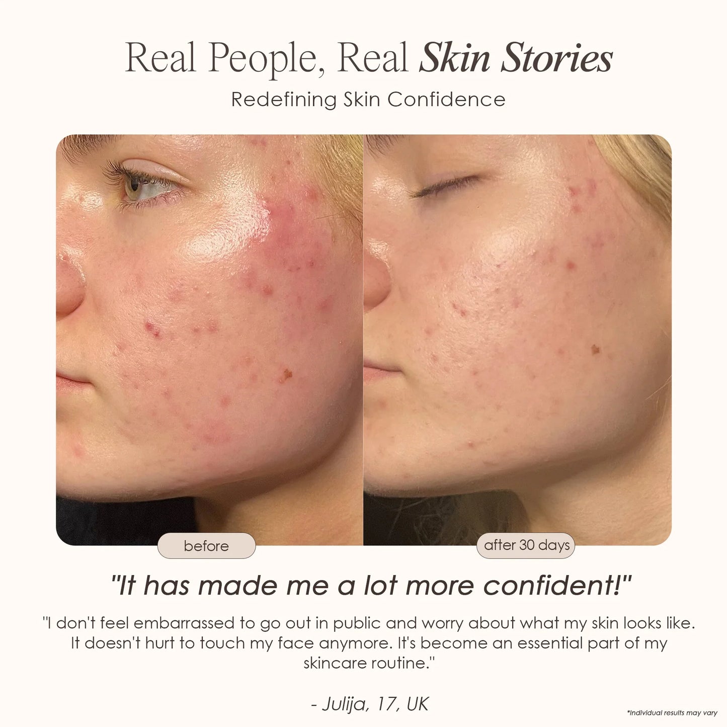 Yael Amari™ | Red Light Therapy Mask LED Face Mask