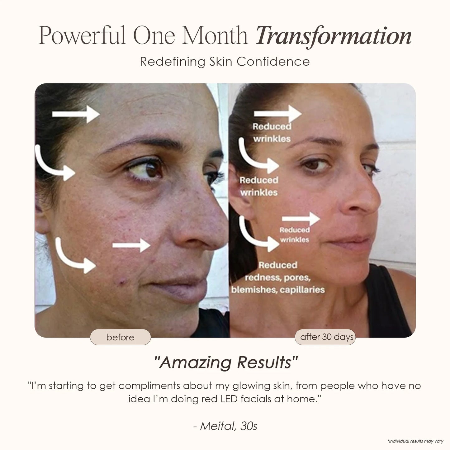 Yael Amari™ | Red Light Therapy Mask LED Face Mask