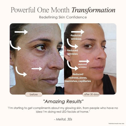 Yael Amari™ | Red Light Therapy Mask LED Face Mask