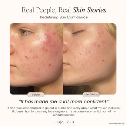 Yael Amari™ | Red Light Therapy Mask LED Face Mask